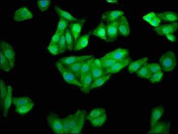 CHKB Antibody