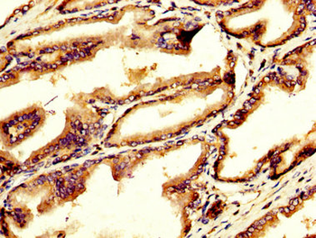 GDF10 Antibody