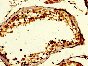 GDF10 Antibody
