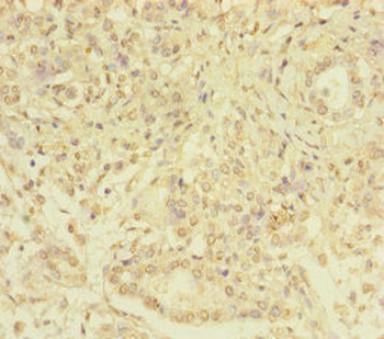SERPINB6 Antibody