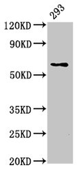 LPCAT2 Antibody