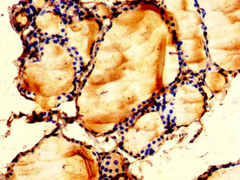 LPCAT2 Antibody