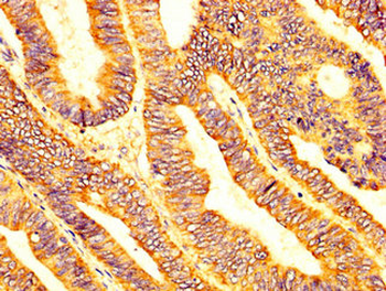 LPCAT2 Antibody