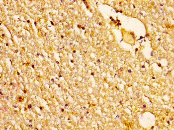 NDUFS2 Antibody