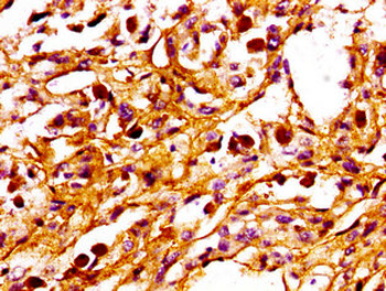 PPM1F Antibody