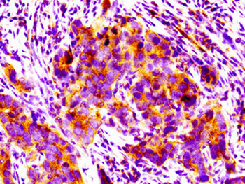PPM1F Antibody