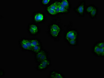 PPM1F Antibody