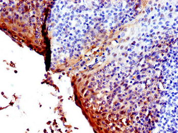SFN Antibody