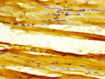 SLC11A1 Antibody