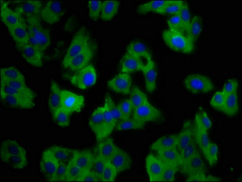 SLC11A1 Antibody
