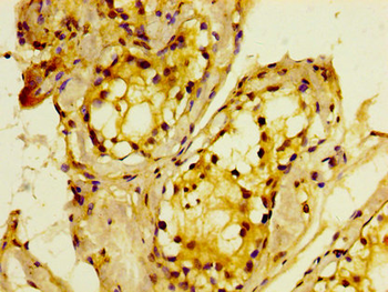 MTMR2 Antibody