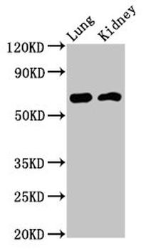 IQCB1 Antibody