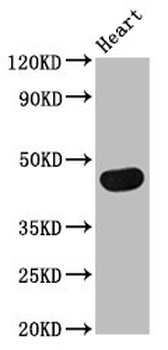 TRDMT1 Antibody