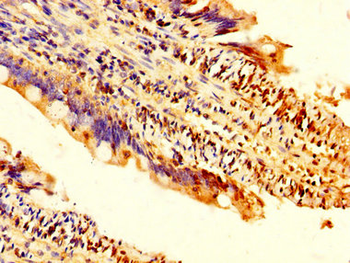 TRDMT1 Antibody