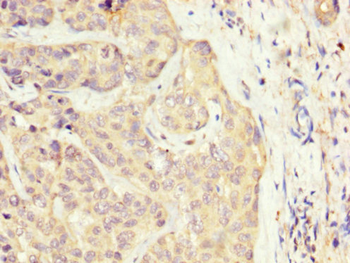 SLC22A25 Antibody