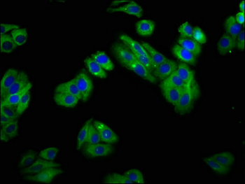 SLC22A25 Antibody