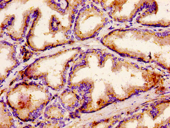 ACBD3 Antibody