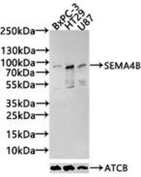 SEMA4B Antibody