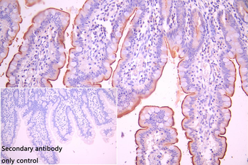 SEMA4B Antibody