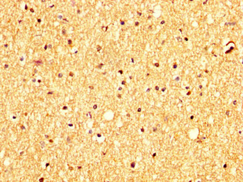 RHCG Antibody