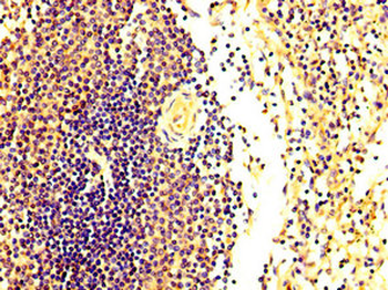 FASTKD2 Antibody
