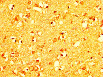 RAB26 Antibody