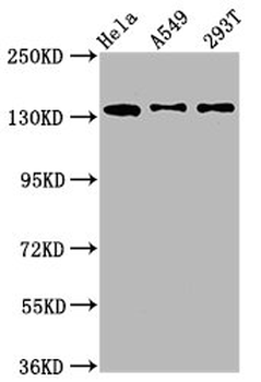 MAN2B2 Antibody