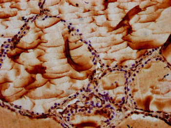 MAN2B2 Antibody