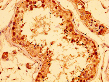 ERI1 Antibody