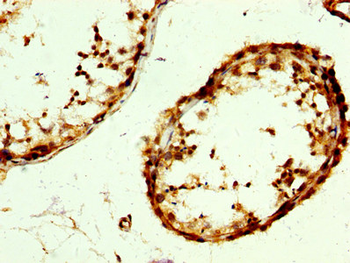 RAB3GAP2 Antibody