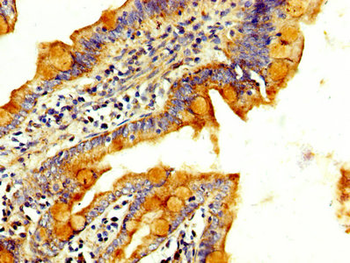 RAB3GAP2 Antibody