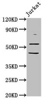 CHRNB2 Antibody