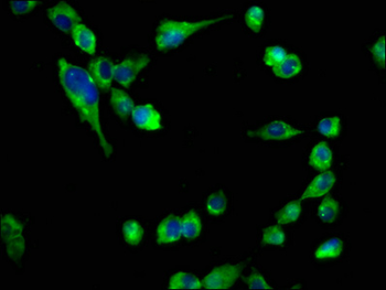 CHRNB2 Antibody
