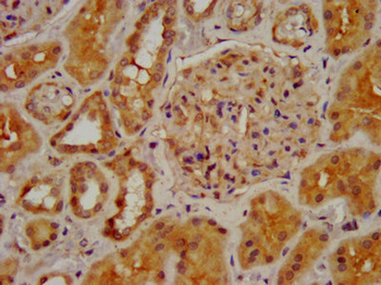 CHRNB2 Antibody