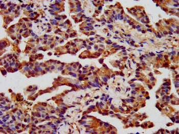 CHRNB3 Antibody