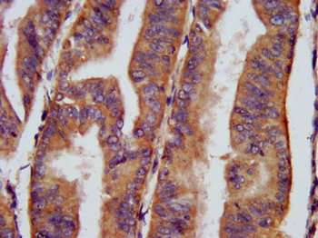 CHRNB3 Antibody