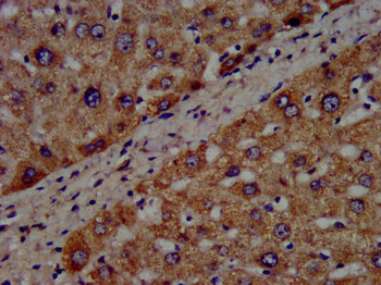 CYP8B1 Antibody