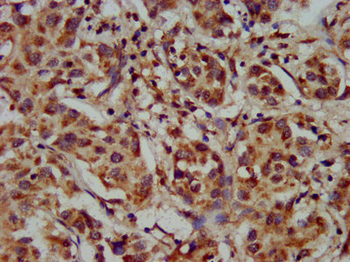CYP8B1 Antibody