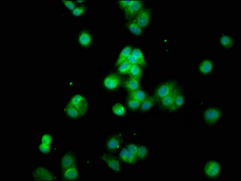 CYP8B1 Antibody