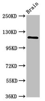 HIP1R Antibody