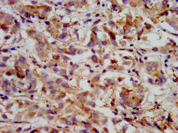 HMGCS2 Antibody