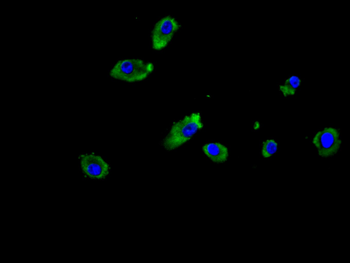 ITGB6 Antibody