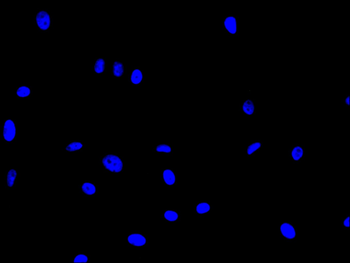 ITGB6 Antibody