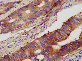 PCSK2 Antibody