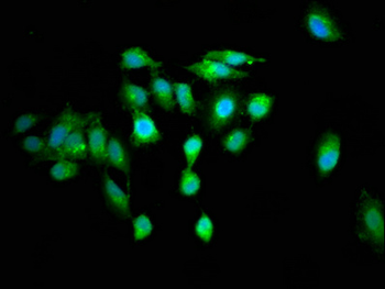 RGS6 Antibody