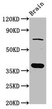 SCAMP1 Antibody