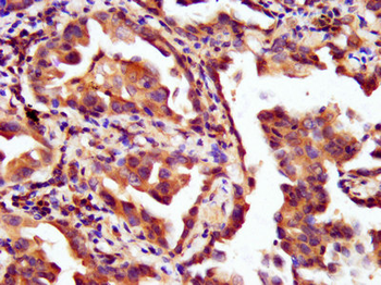 LAMC2 Antibody