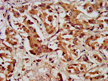 LAMC2 Antibody