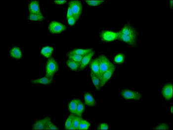 RBM45 Antibody