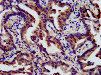 SSH3 Antibody